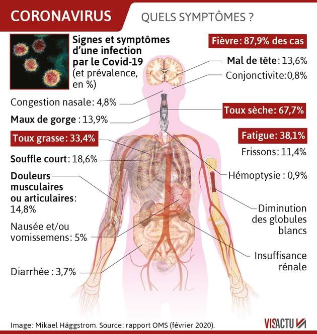 CORONAVIRUS- QUELS SONT LES SYMPTÔMES D’UNE CONTAMINATION AU COVID-19 ?